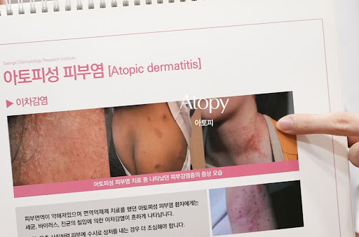 생기한의원으로 살펴보는 아토피 수면 부족과 증상 변화